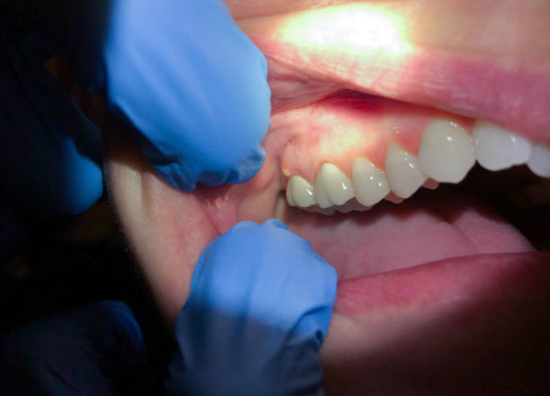 Best Tooth Infection Emergency Dentist  in Wayne, MI